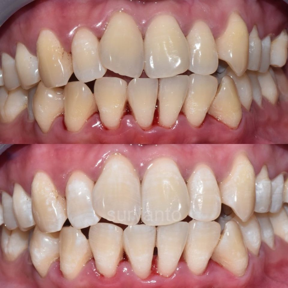 Hasil perawatan Bioesthetic Dental 12