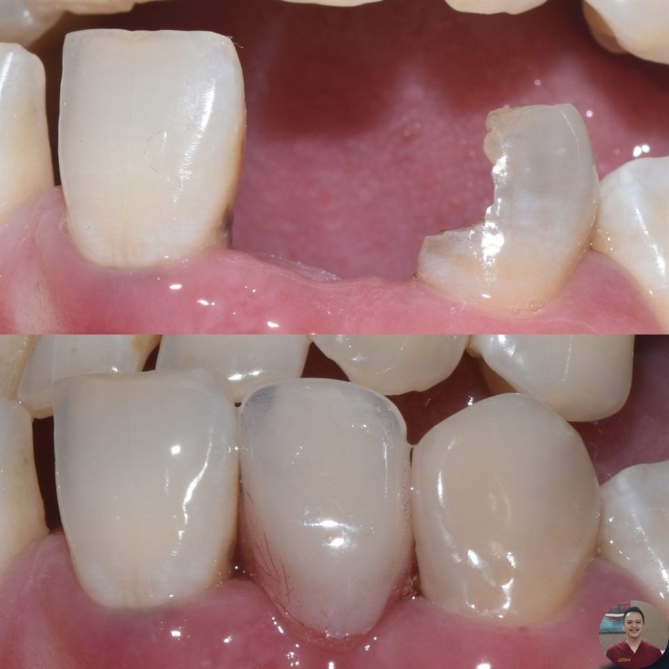 Gigi Palsu katalog 1