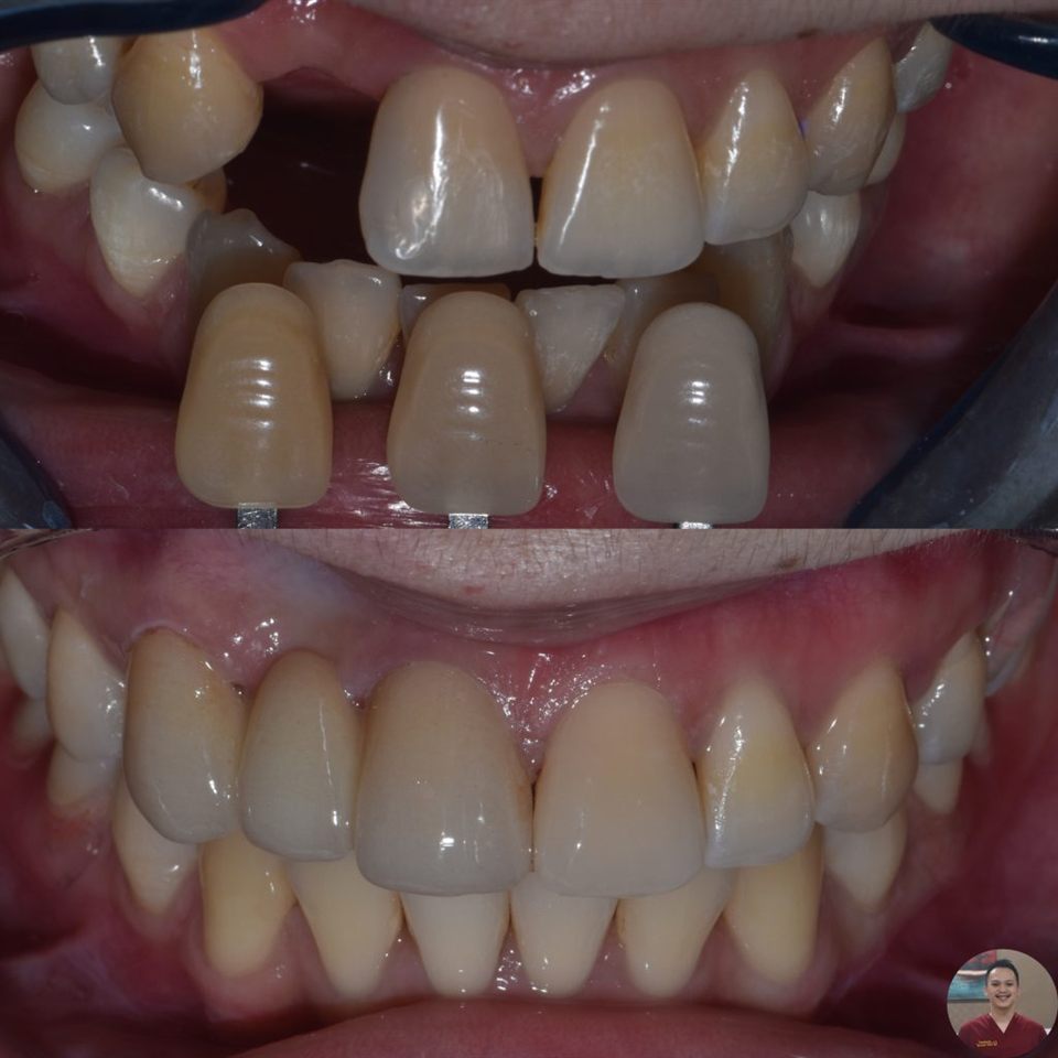 Gigi Palsu katalog 2