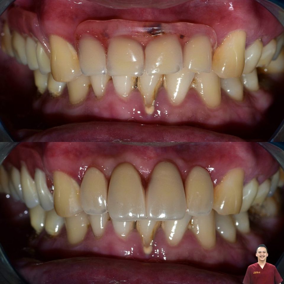 Gigi Palsu katalog 5