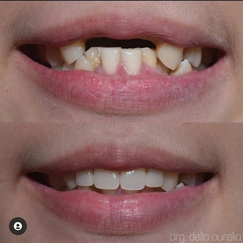 Gigi Palsu katalog 6