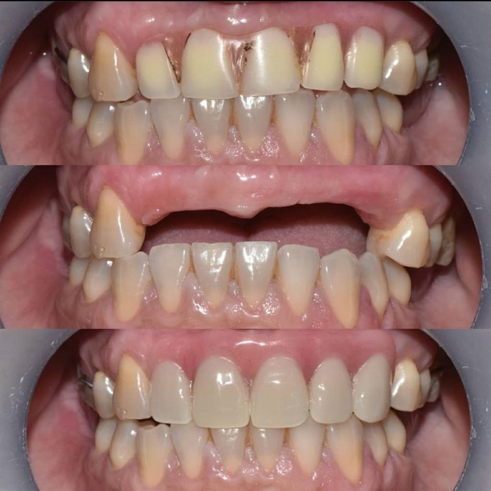 Gigi Palsu katalog 7