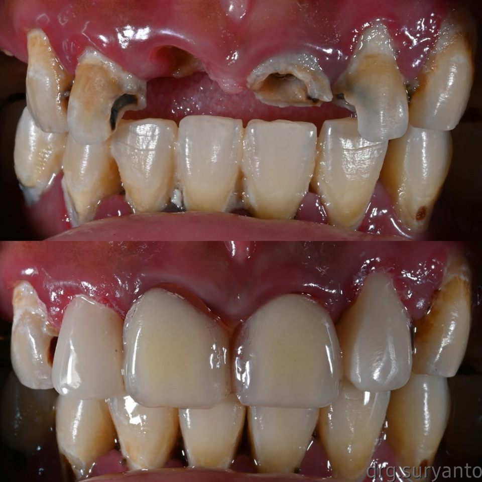 Gigi Palsu katalog 8