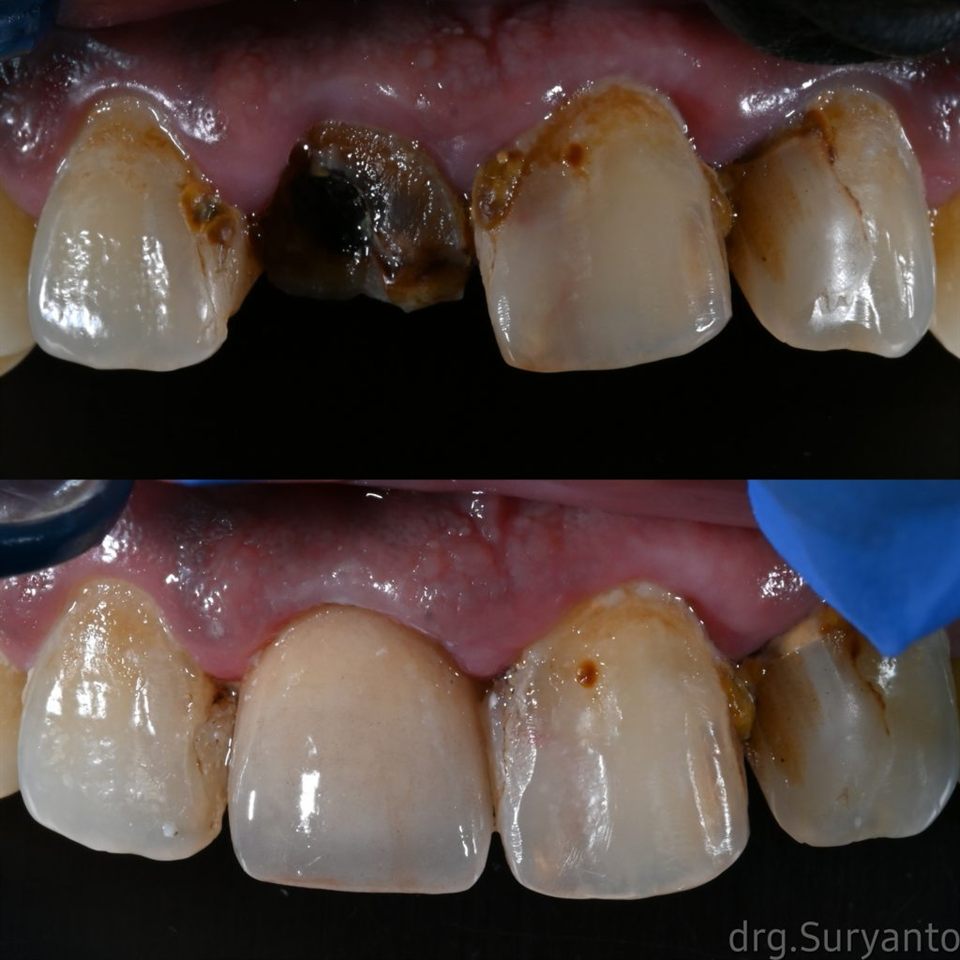 Gigi Palsu katalog 12