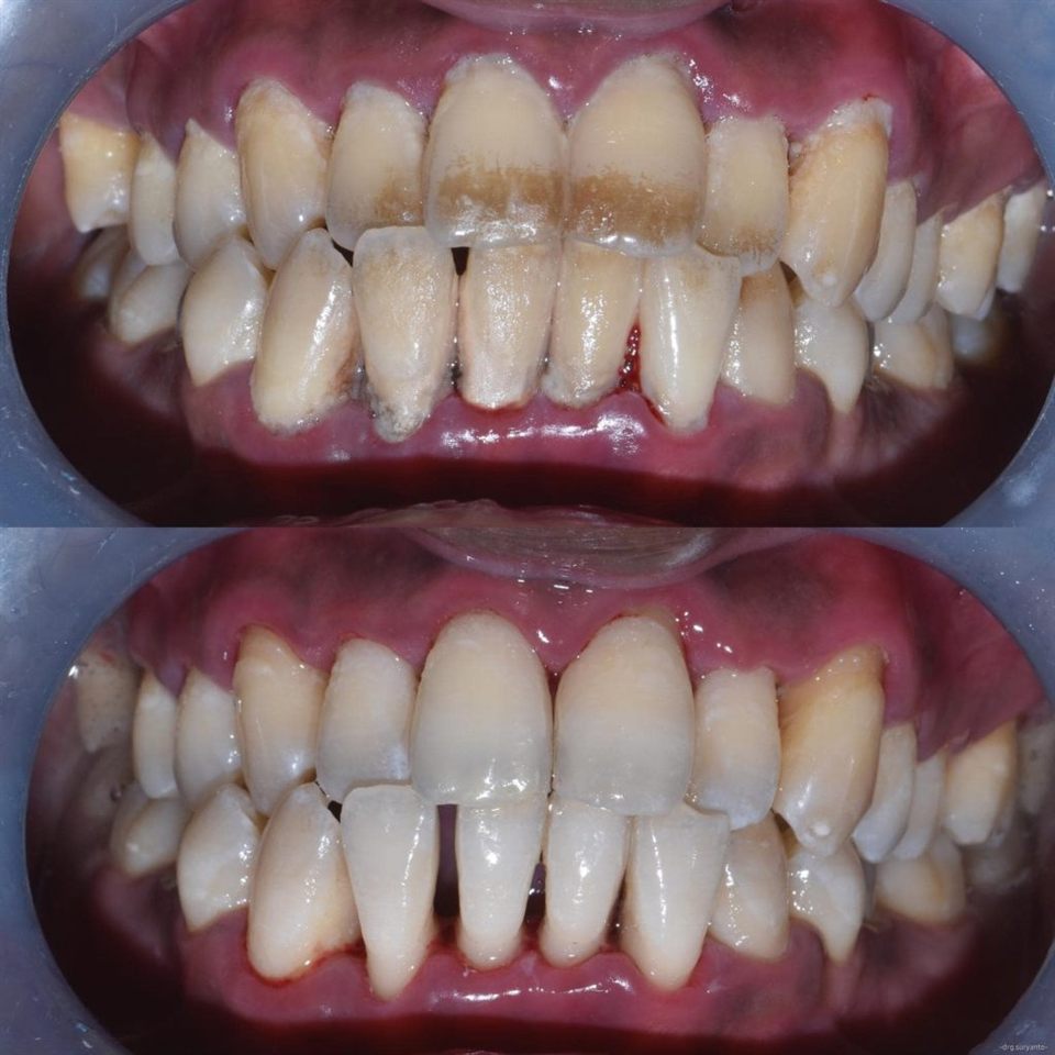 Scaling Gigi katalog 2