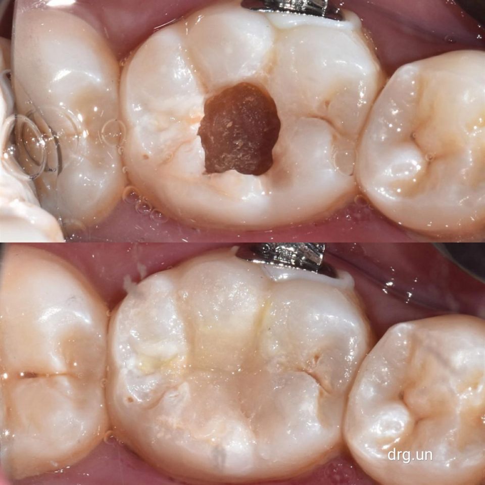 Tambal Gigi katalog 1