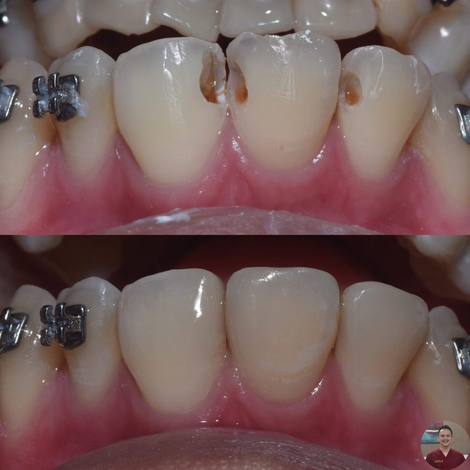 Tambal Gigi katalog 3