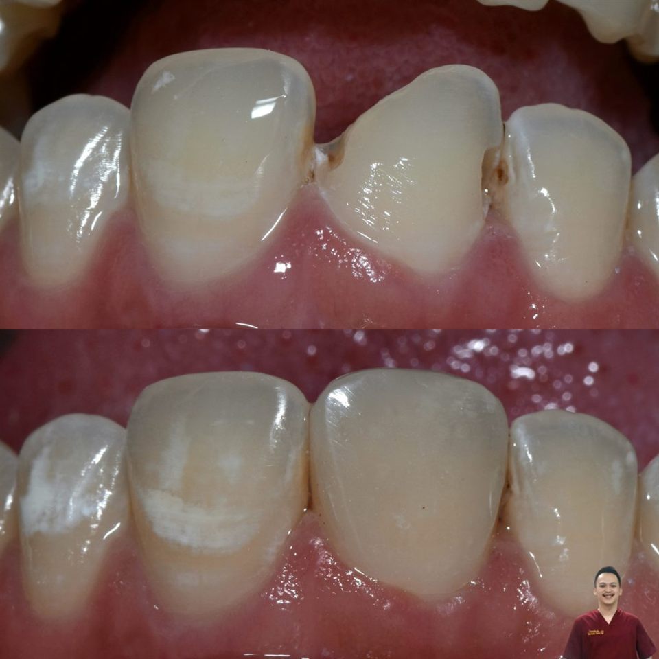 Tambal Gigi katalog 5