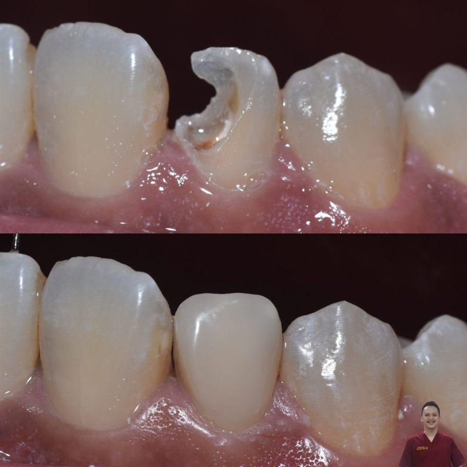 Tambal Gigi katalog 7