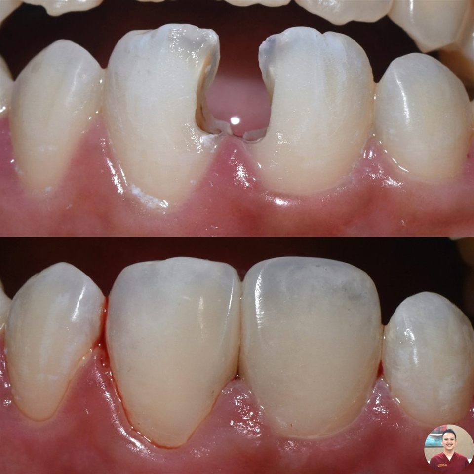 Tambal Gigi katalog 10