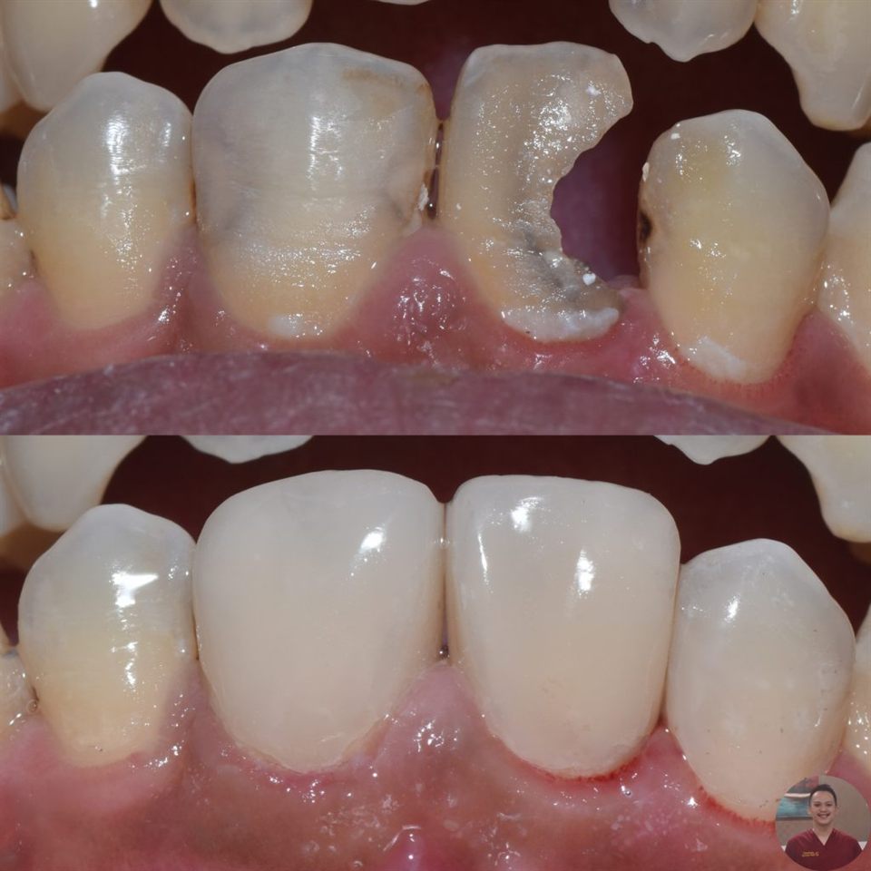 Hasil perawatan Bioesthetic Dental 4