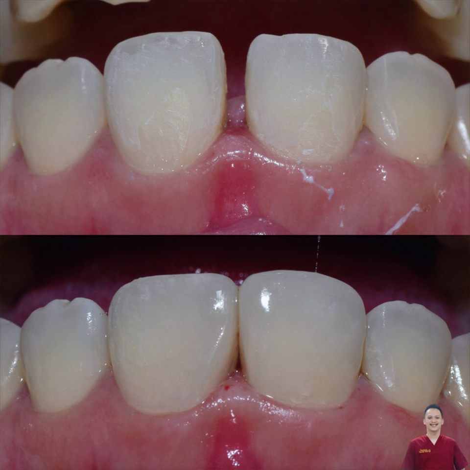 Hasil perawatan Bioesthetic Dental 6