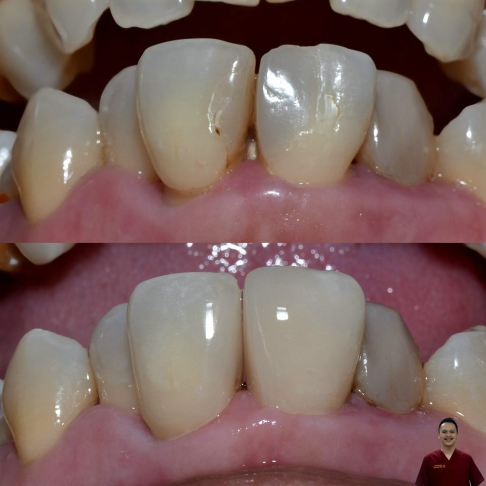 Hasil perawatan Bioesthetic Dental 7