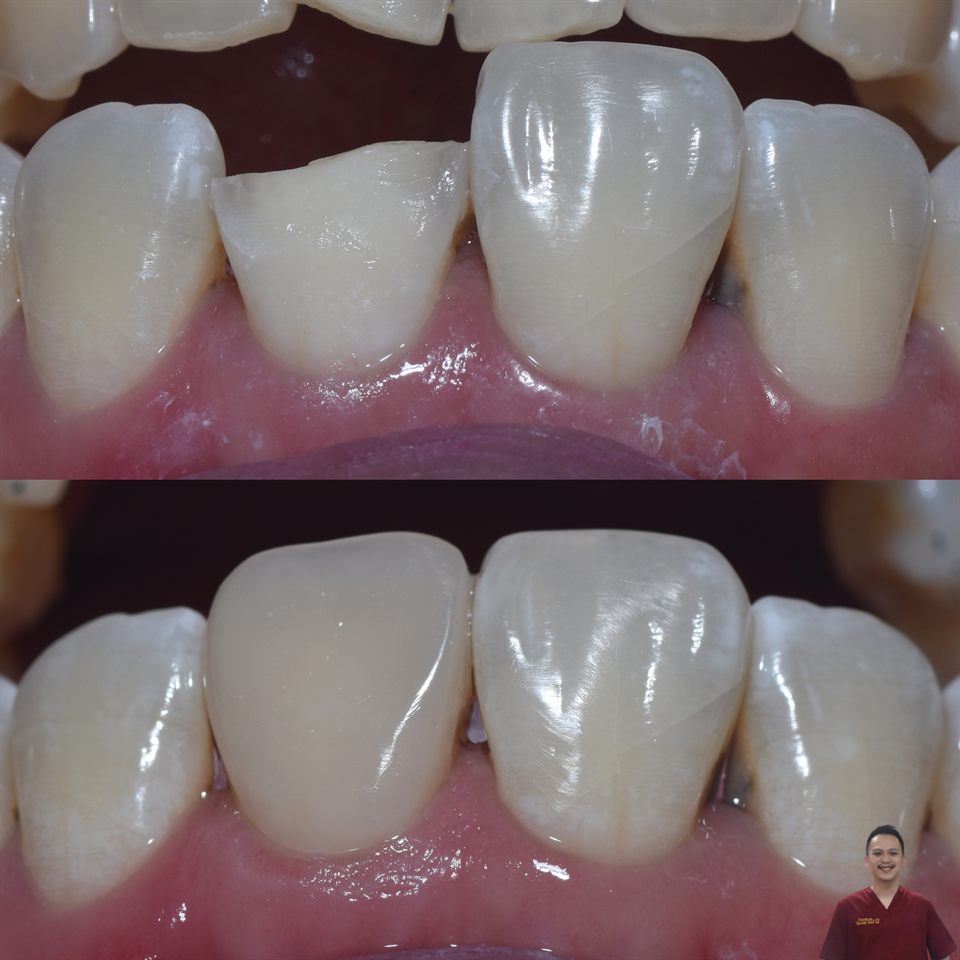 Natural Veneer hasil 13