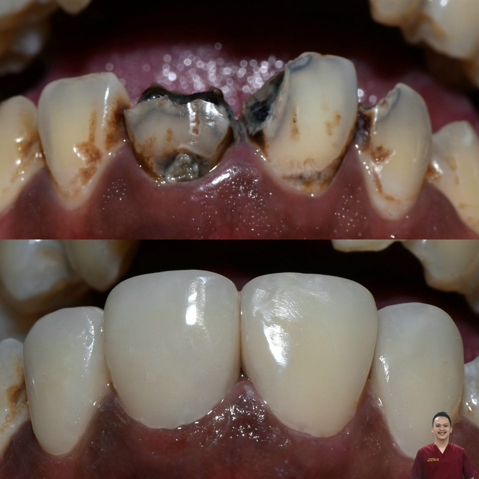 Natural Veneer hasil 14