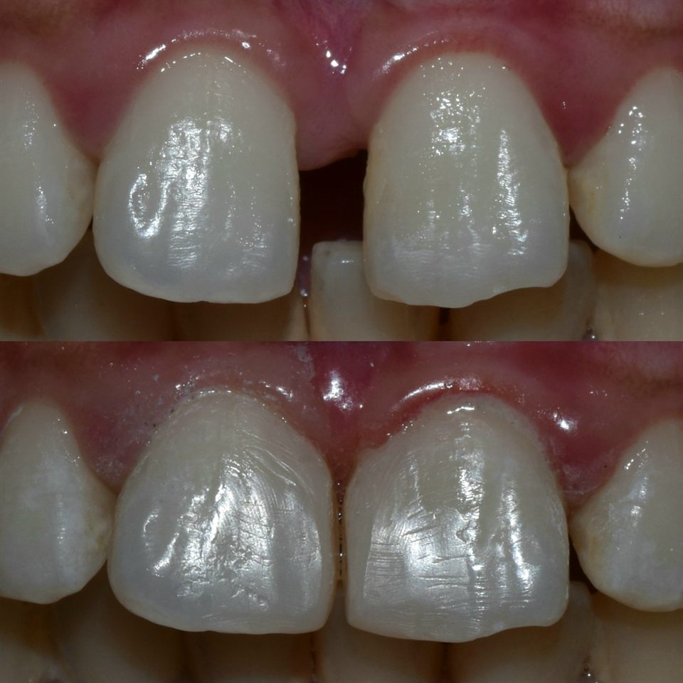Natural Veneer hasil 16