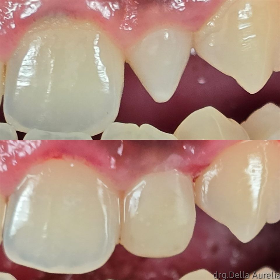 Natural Veneer hasil 17