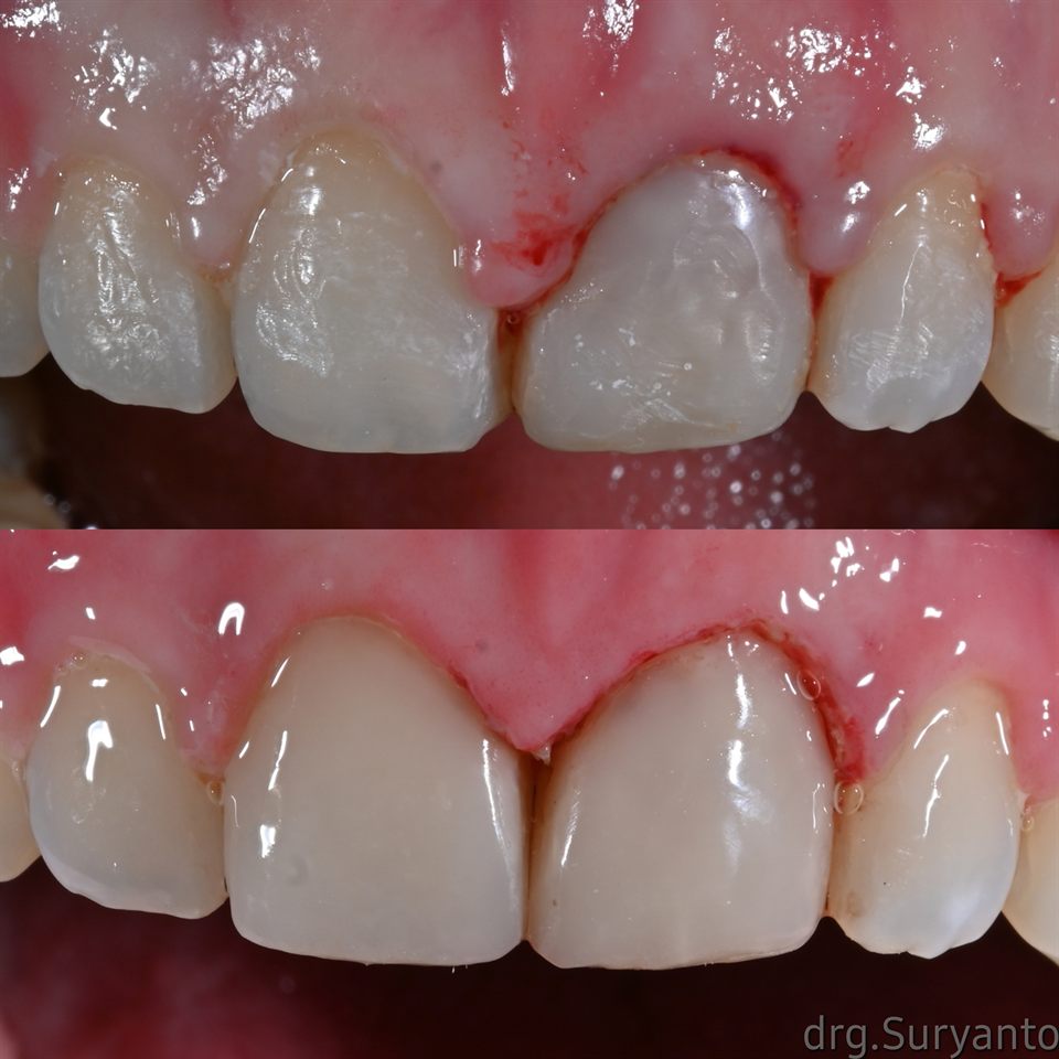 Natural Veneer hasil 19