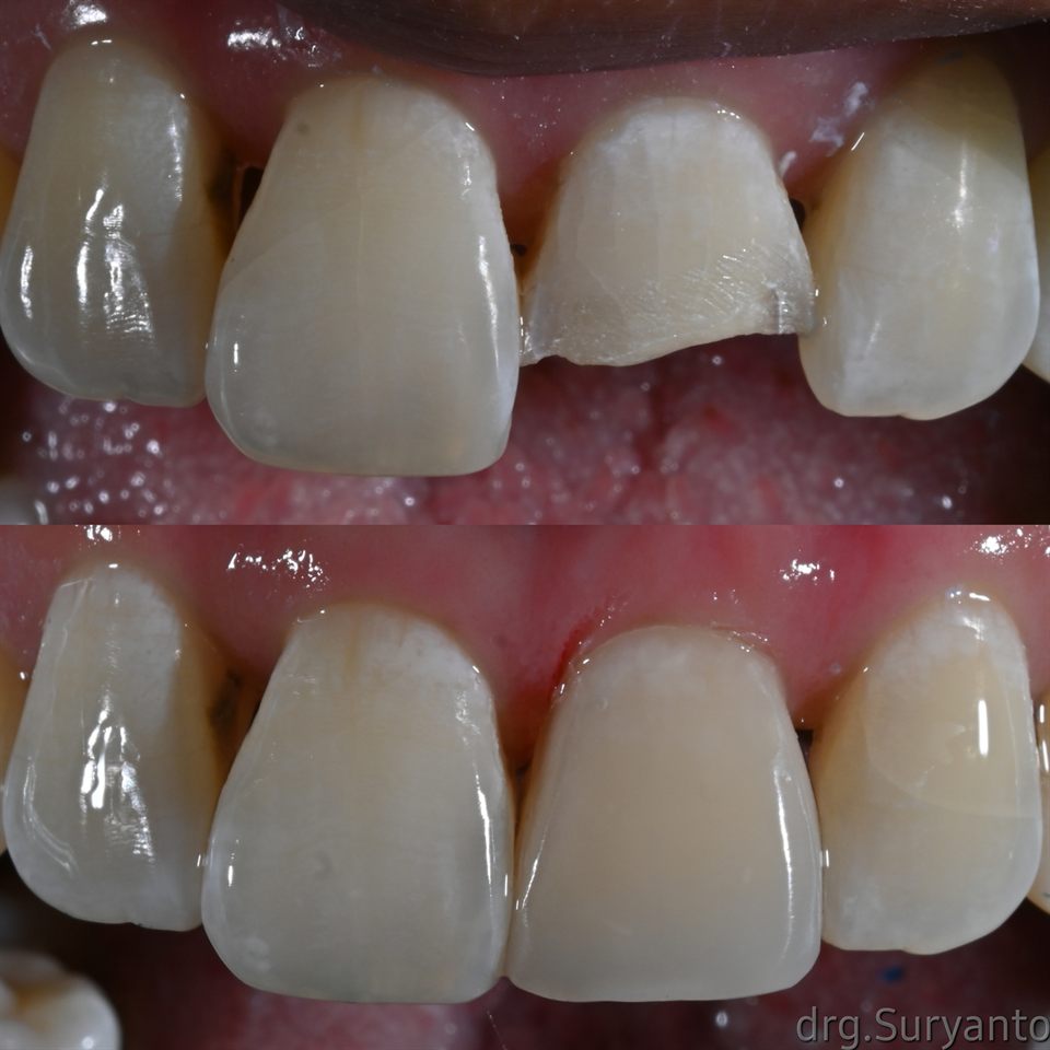 Natural Veneer hasil 21
