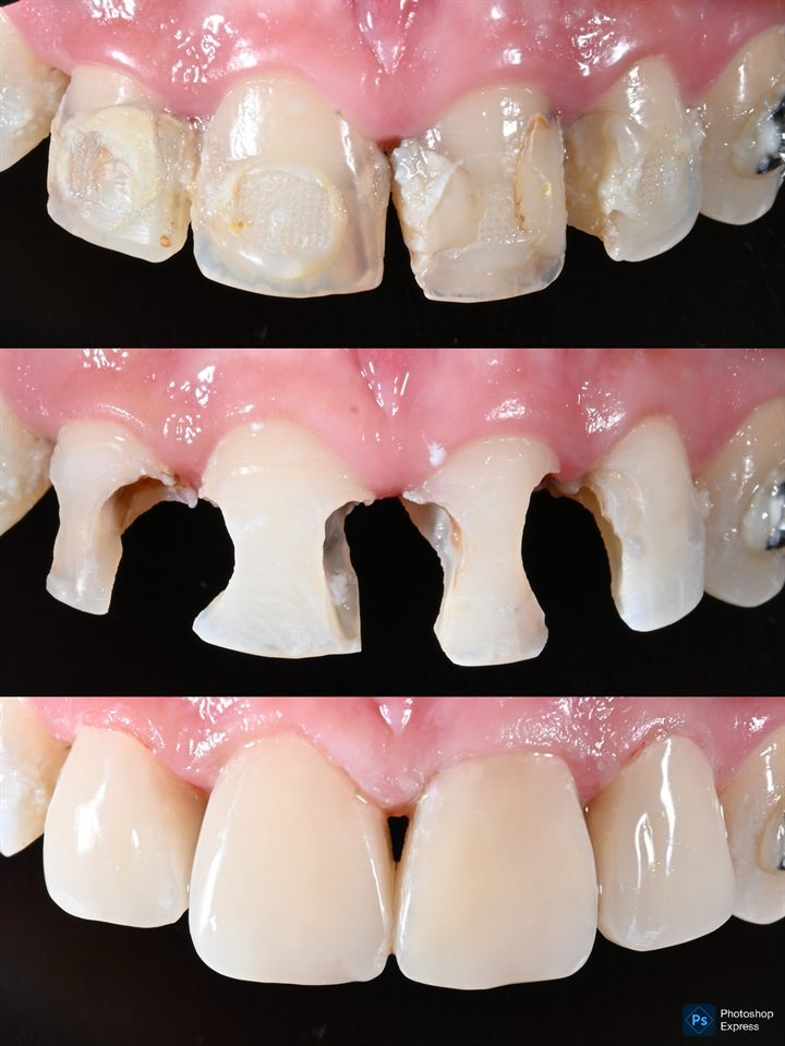 Natural Veneer hasil 22