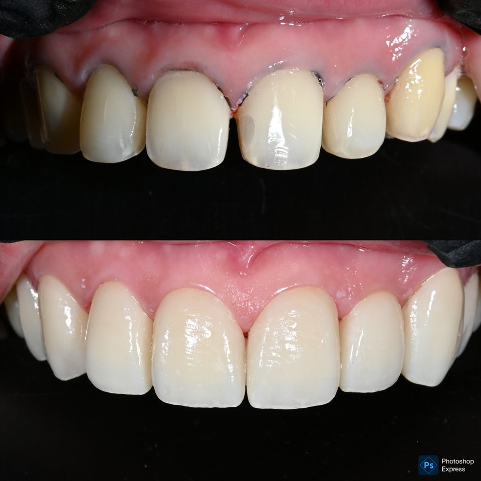 Natural Veneer hasil 26