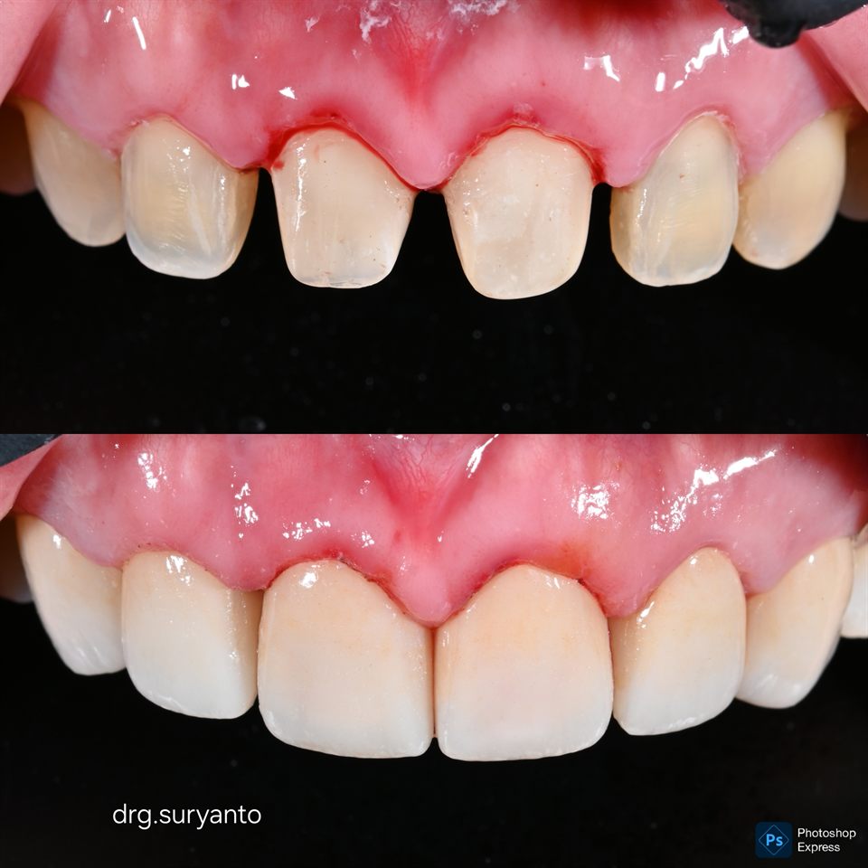 Natural Veneer hasil 27